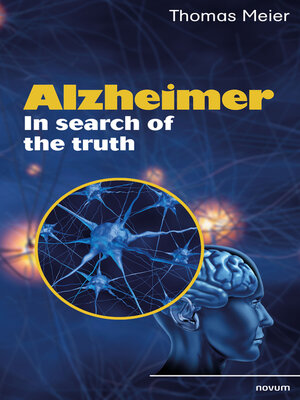 cover image of Alzheimer--In search of the truth